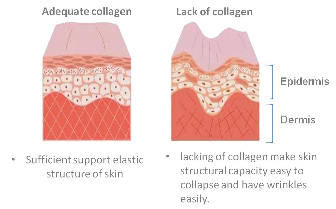 Why collagen is a great ingredient for skin care?